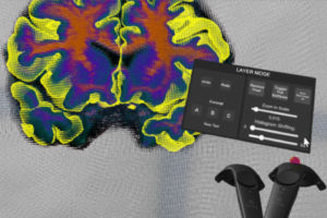 virtual-brain-segementer-web